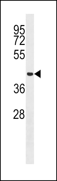 Western blot analysis in HepG2 cell line lysates (35ug/lane). Western blot analysis in HepG2 cell line lysates (35ug/lane).