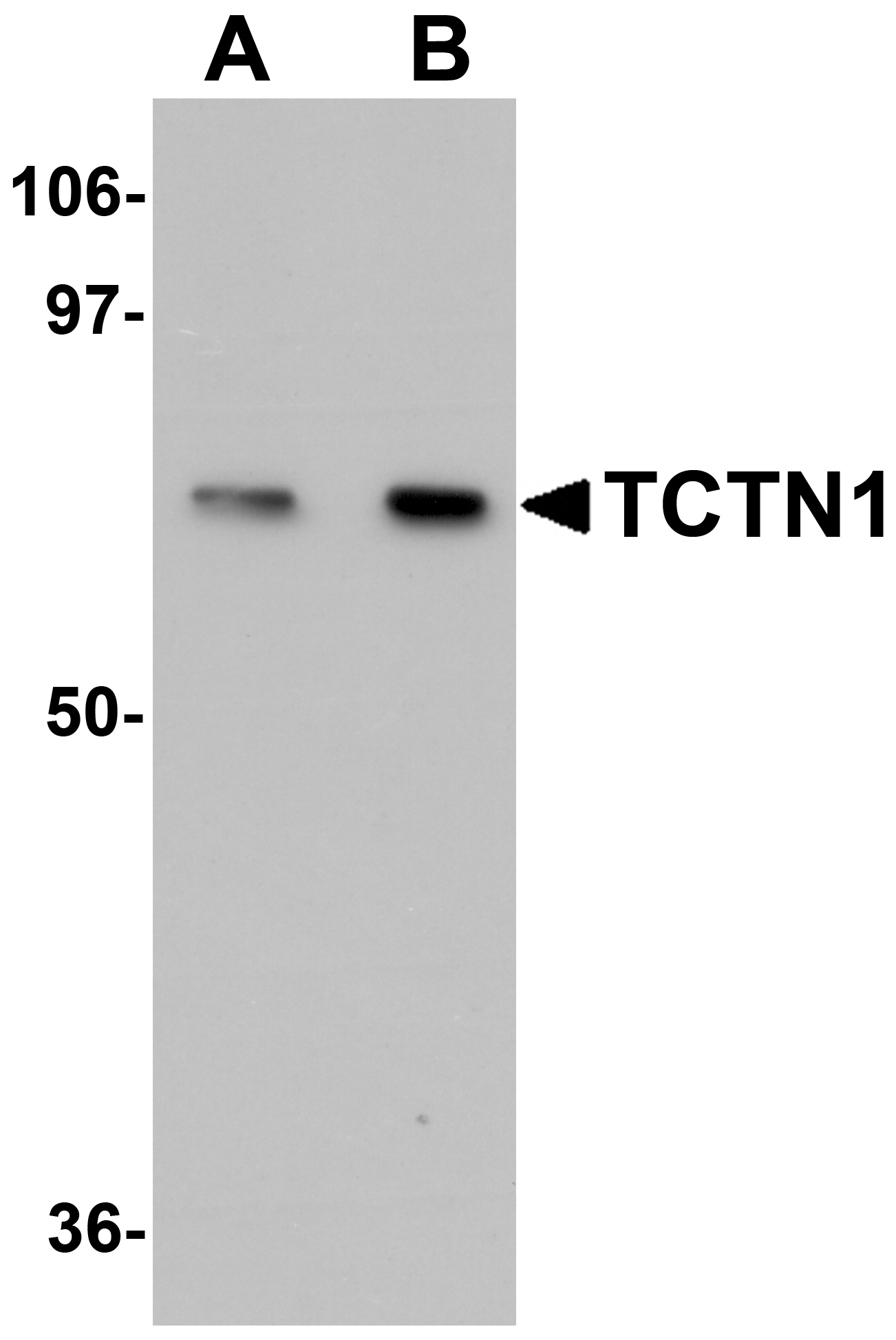 Western blot analysis of TCTN1 in mouse kidney tissue lysate with TCTN1 antibody at (A) 1 and (B) 2μg/mL. Western blot analysis of TCTN1 in mouse kidney tissue lysate with TCTN1 antibody at (A) 1 and (B) 2μg/mL.