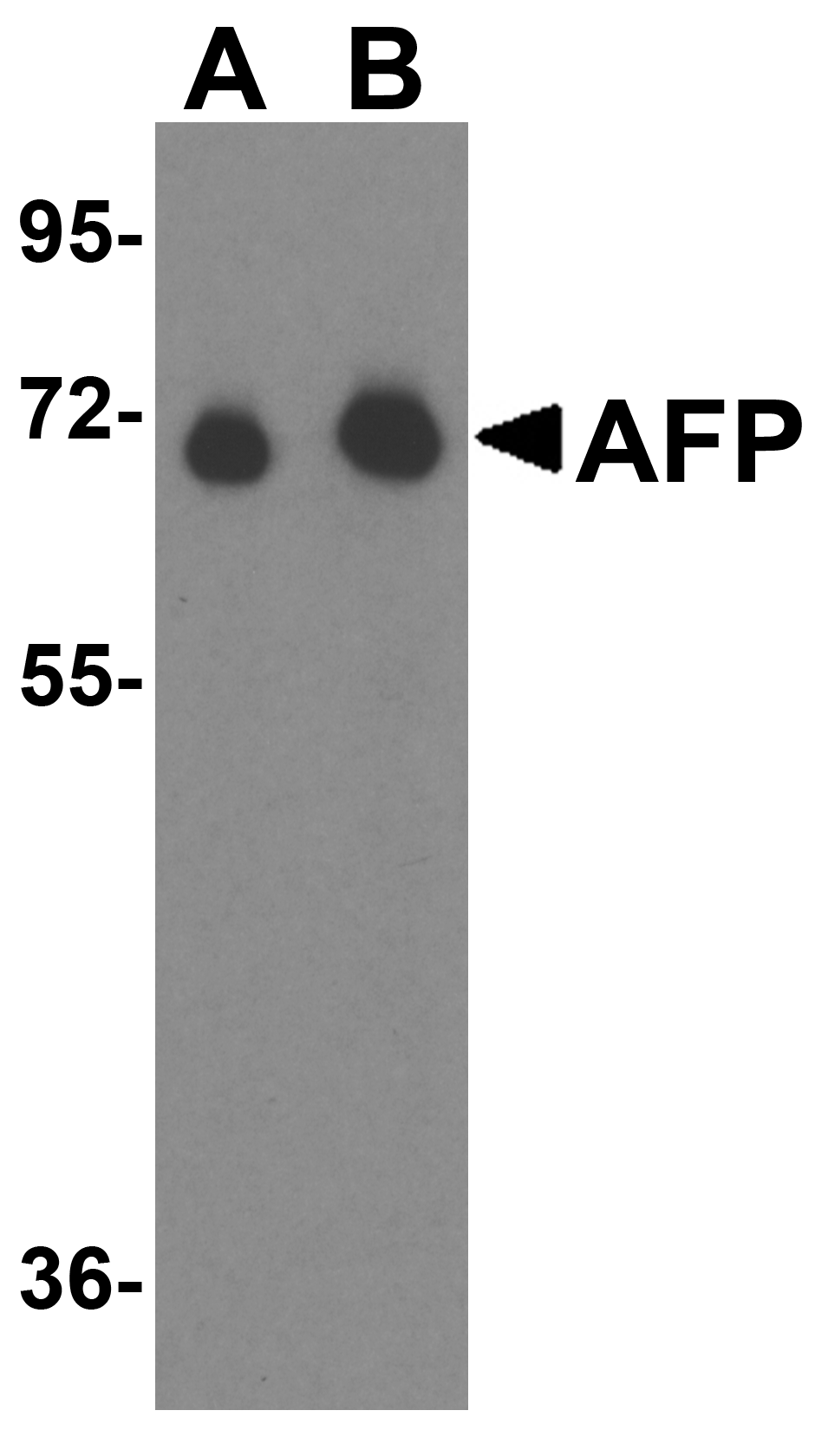 Western blot analysis of AFP in fetal human liver tissue lysate with AFP antibody at (A) 1 μg/mL and (B) 2 μg/mL. Western blot analysis of AFP in fetal human liver tissue lysate with AFP antibody at (A) 1 μg/mL and (B) 2 μg/mL.