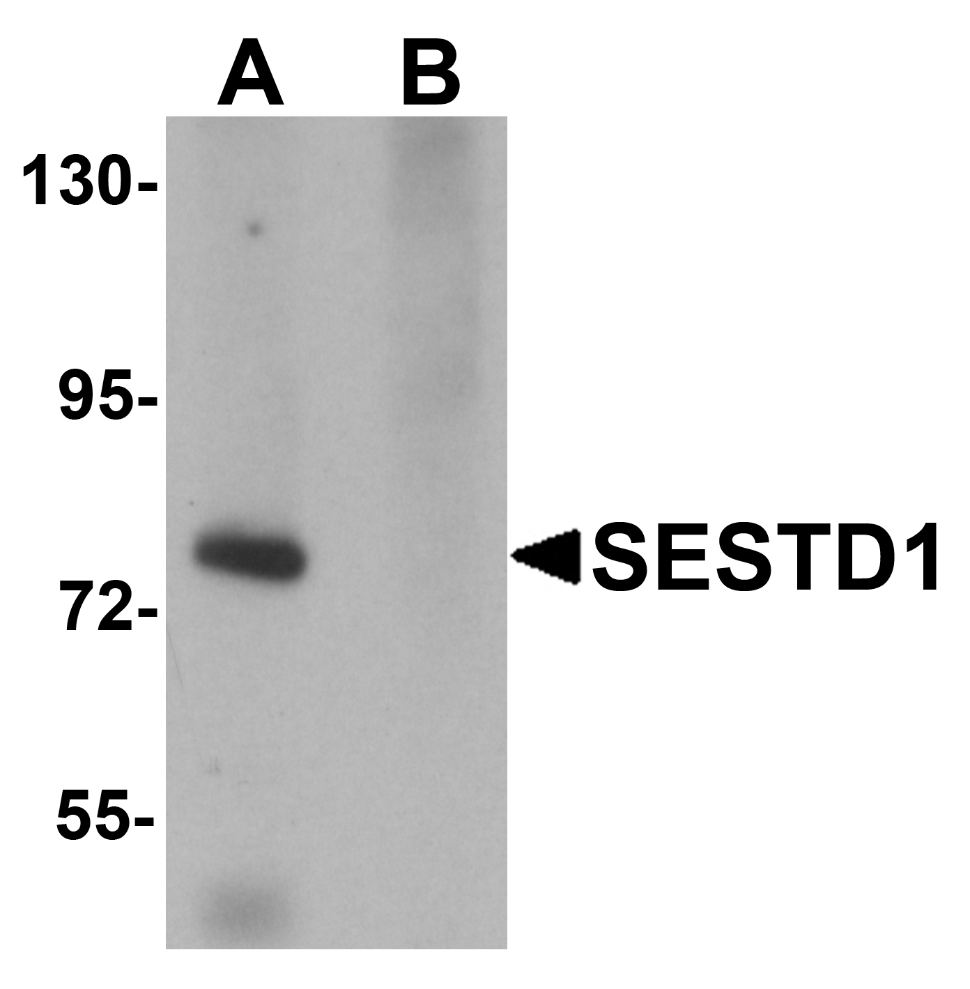 Western blot analysis of SESTD1 in rat brain tissue lysate with SESTD1 antibody at 1 μg/mL in (A) the absence and (B) the presence of blocking peptide. Western blot analysis of SESTD1 in rat brain tissue lysate with SESTD1 antibody at 1 μg/mL in (A) the absence and (B) the presence of blocking peptide.