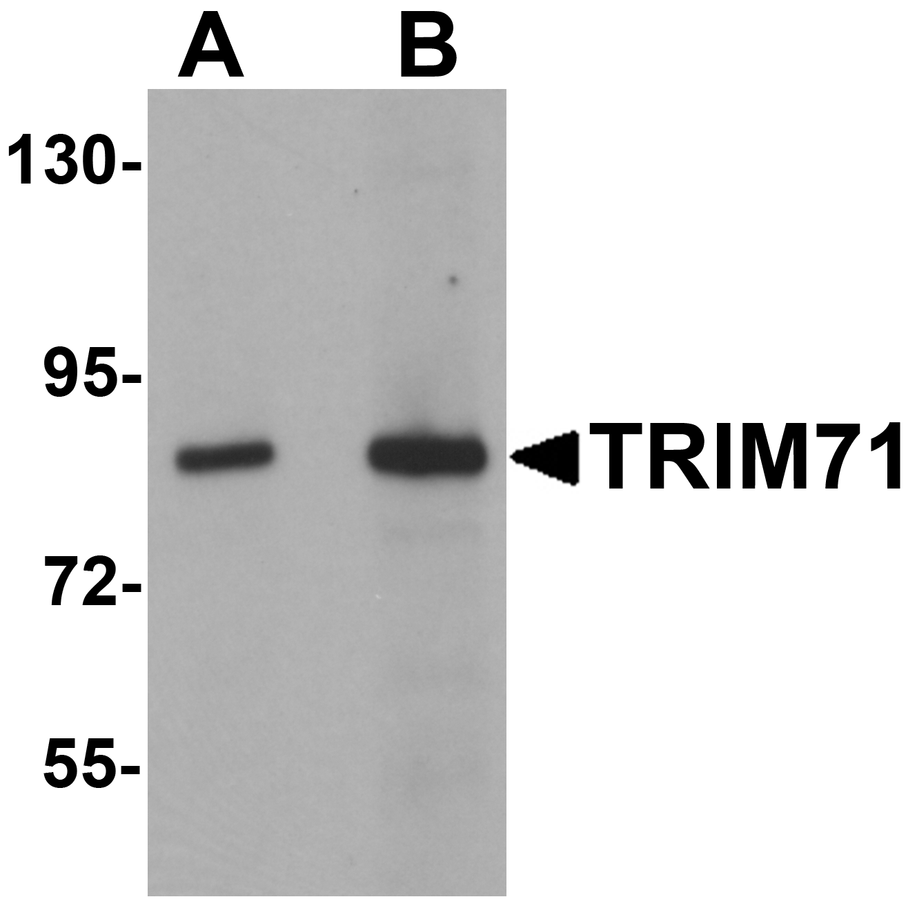 Western blot analysis of TRIM71 in human brain tissue lysate with TRIM71 antibody at (A) 1 and (B) 2 μg/mL. Western blot analysis of TRIM71 in human brain tissue lysate with TRIM71 antibody at (A) 1 and (B) 2 μg/mL.