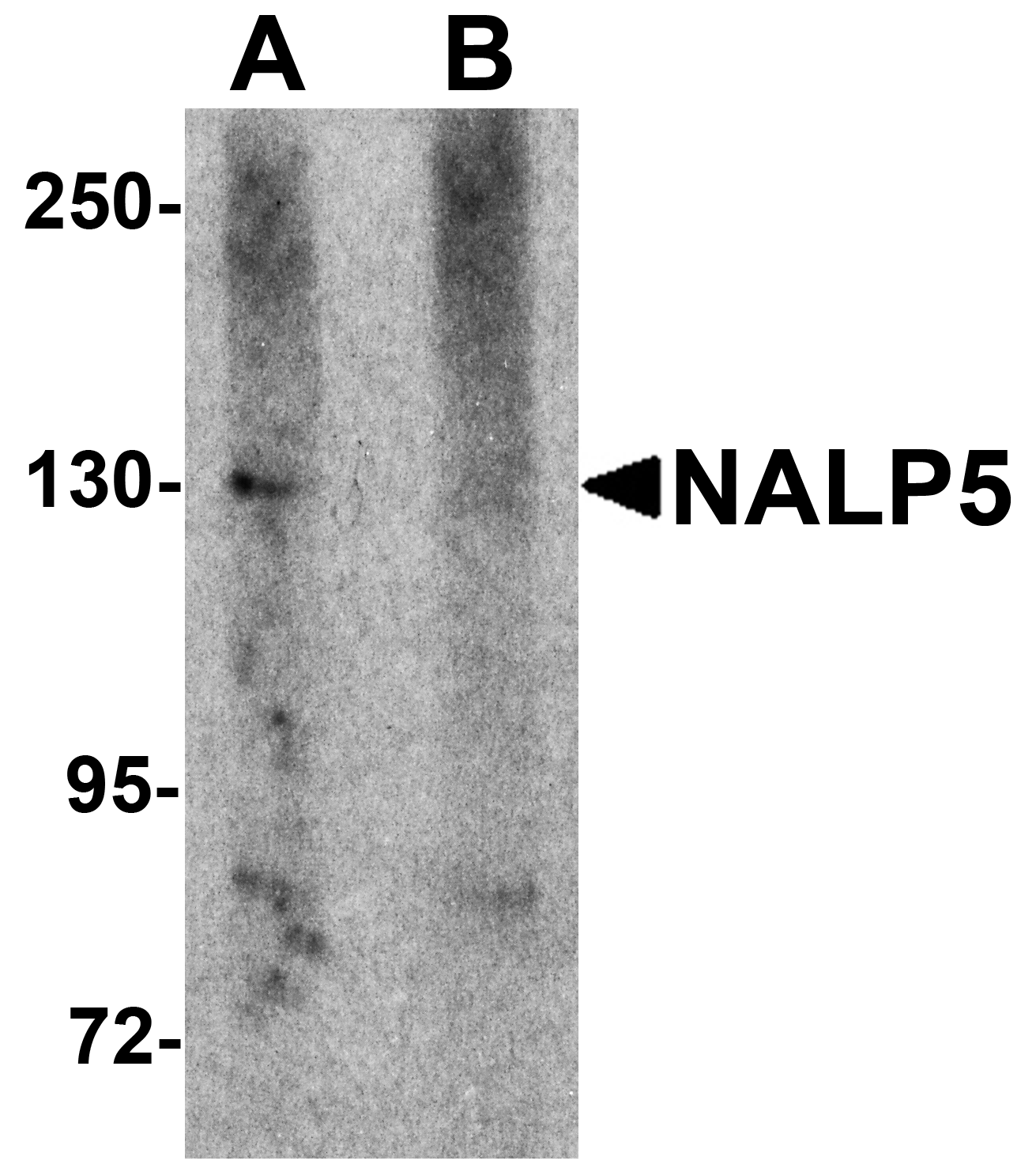 Western blot analysis of NALP5 in mouse brain tissue lysate with NALP5 antibody at 1 μg/mL in (A) the absence and (B) the presence of blocking peptide.