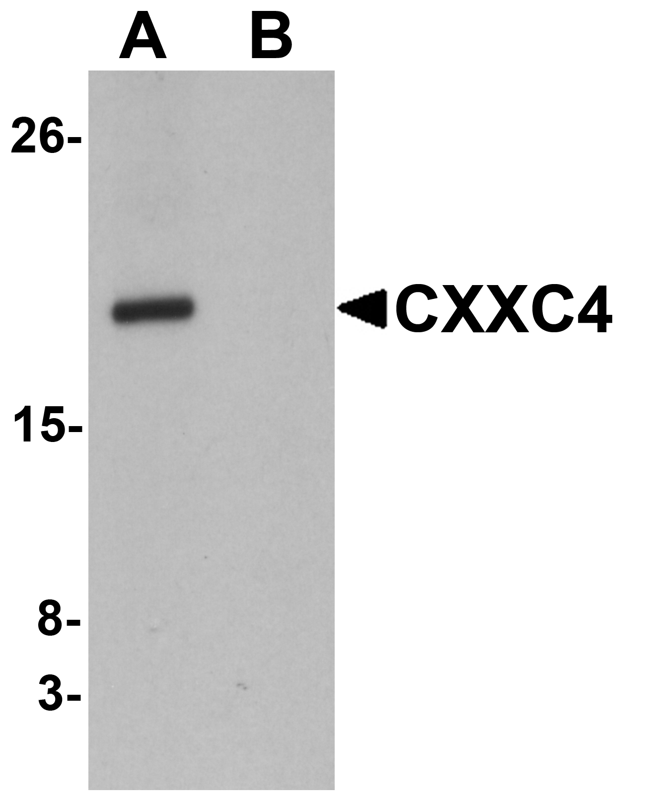 Western blot analysis of CXXC4 in human brain tissue lysate with CXXC4 antibody at 1 μg/mL in (A) the absence and (B) the presence of blocking peptide. Western blot analysis of CXXC4 in human brain tissue lysate with CXXC4 antibody at 1 μg/mL in (A) the absence and (B) the presence of blocking peptide.