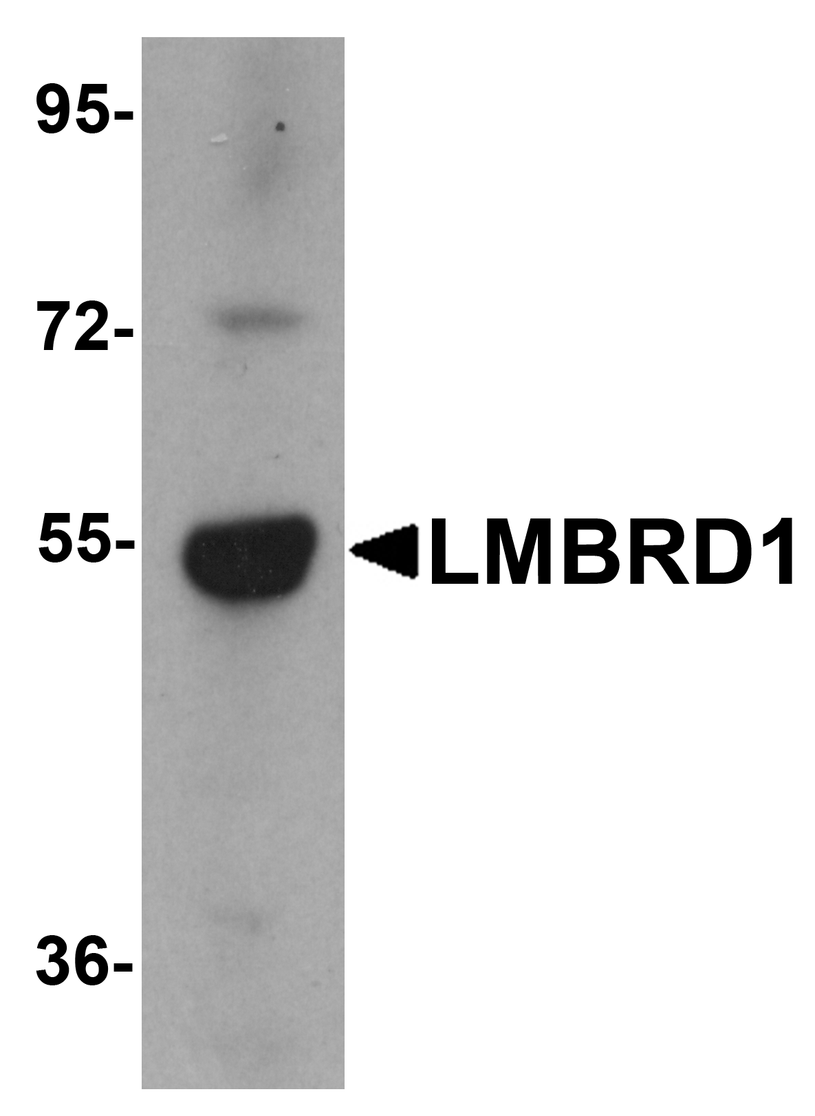 Western blot analysis of LMBRD1 in human brain tissue lysate with LMBRD1 antibody at 1 μg/mL. Western blot analysis of LMBRD1 in human brain tissue lysate with LMBRD1 antibody at 1 μg/mL.