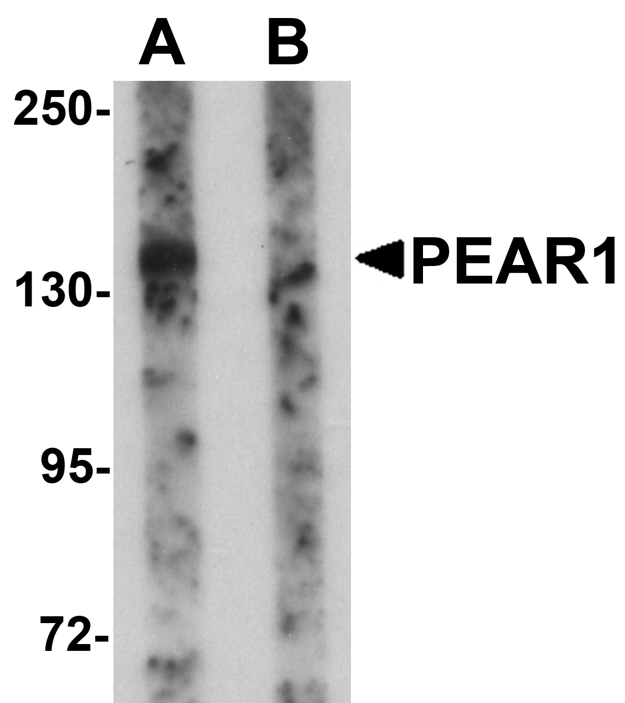 Western blot analysis of PEAR1 in rat kidney tissue lysate with PEAR1 antibody at 1 μg/mL in (A) the absence and (B) the presence of blocking peptide. Western blot analysis of PEAR1 in rat kidney tissue lysate with PEAR1 antibody at 1 μg/mL in (A) the absence and (B) the presence of blocking peptide.