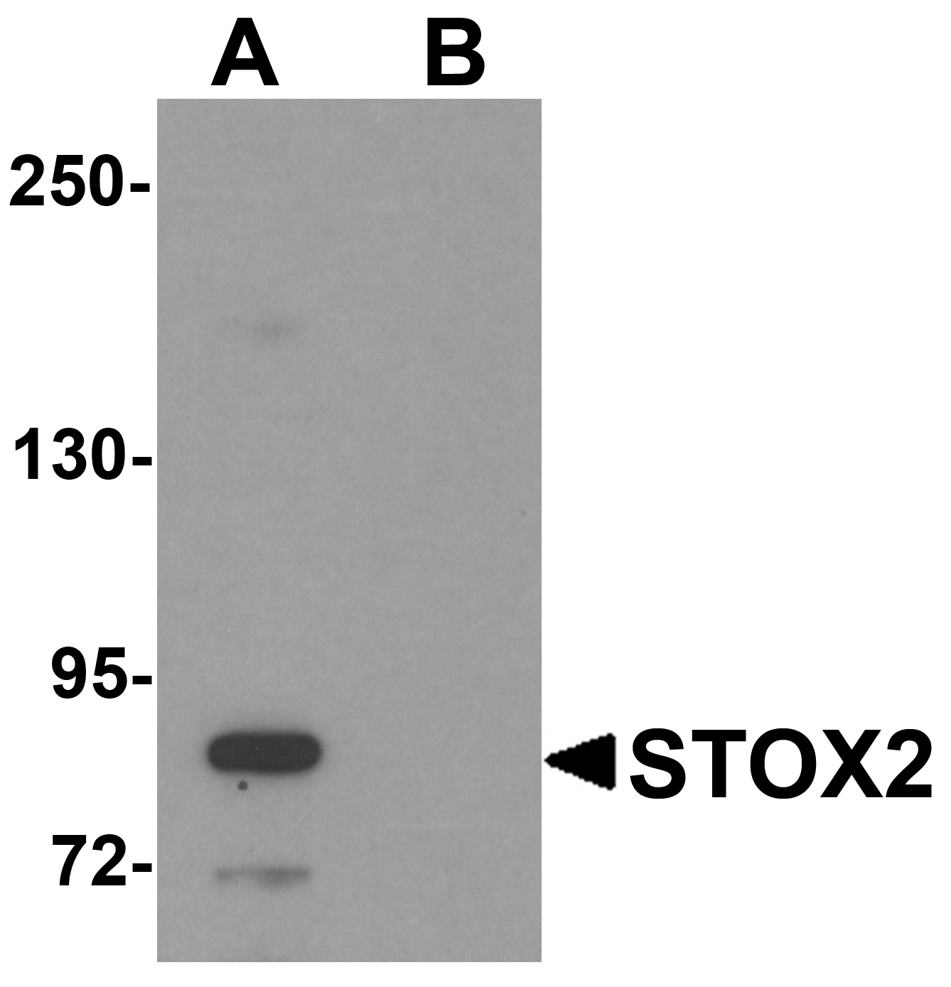 Western blot analysis of STOX2 in human kidney tissue lysate with STOX2 antibody at 1 μg/mL in (A) the absence and (B) the presence of blocking peptide. Western blot analysis of STOX2 in human kidney tissue lysate with STOX2 antibody at 1 μg/mL in (A) the absence and (B) the presence of blocking peptide.