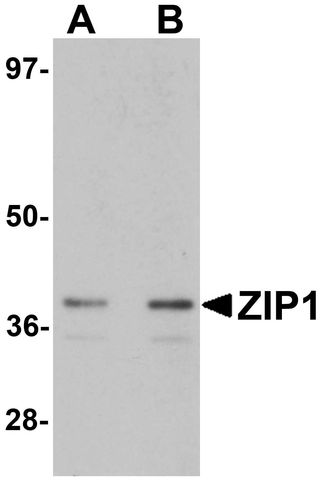 Western blot analysis of ZIP1 in mouse kidney tissue lysate with ZIP1 antibody at (A) 1 and (B) 2 μg/mL. Western blot analysis of ZIP1 in mouse kidney tissue lysate with ZIP1 antibody at (A) 1 and (B) 2 μg/mL.