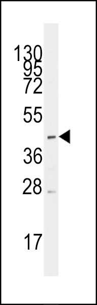 Western blot analysis of anti-SLC16A1 Antibody in CEM cell line lysates (35ug/lane) Western blot analysis of anti-SLC16A1 Antibody in CEM cell line lysates (35ug/lane)