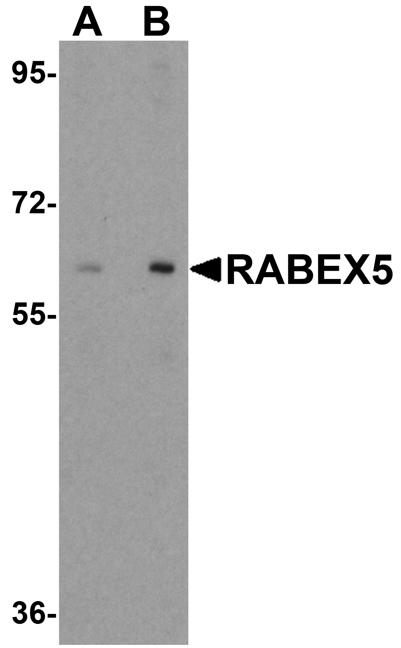 Western blot analysis of RABEX5 in human liver tissue lysate with RABEX5 antibody at (A) 1 and (B) 2 μg/mL. Western blot analysis of RABEX5 in human liver tissue lysate with RABEX5 antibody at (A) 1 and (B) 2 μg/mL.