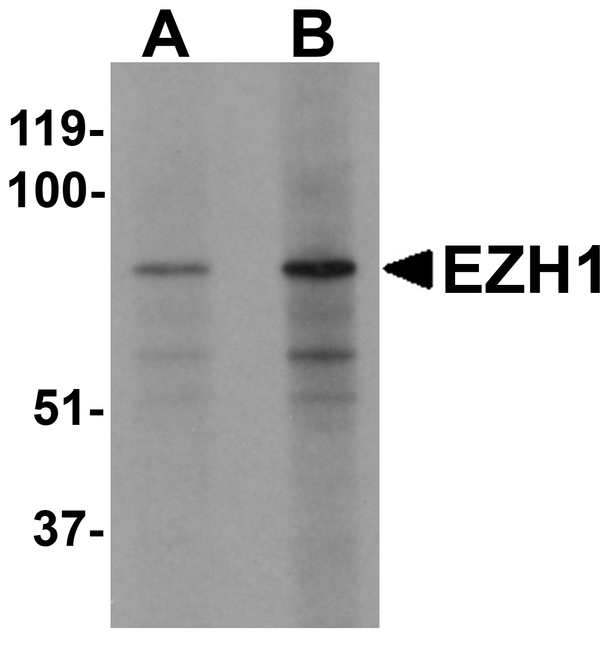 Western blot analysis of EZH1 in mouse lung tissue lysate with EZH1 antibody at (A) 1 and (B) 2 μg/mL Western blot analysis of EZH1 in mouse lung tissue lysate with EZH1 antibody at (A) 1 and (B) 2 μg/mL