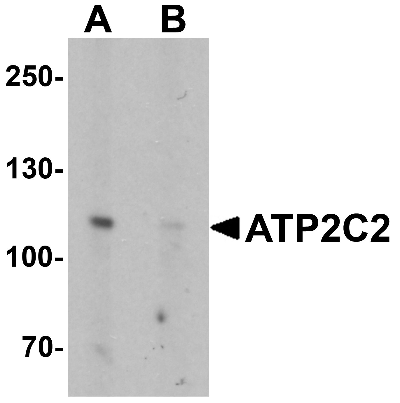 Western blot analysis of ATP2C2 in 3T3 cell lysate with ATP2C2 antibody at 1 μg/mL in (A) the absence and (B) the presence of blocking peptide. Western blot analysis of ATP2C2 in 3T3 cell lysate with ATP2C2 antibody at 1 μg/mL in (A) the absence and (B) the presence of blocking peptide.