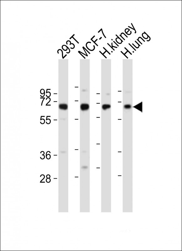 Western Blot at 1:2000 dilution Lane 1: 293T whole cell lysates Lane 2: MCF-7 whole cell lysates Lane 3: human kidney lysates Lane 4: human lung lysates Lysates/proteins at 20 ug per lane. Western Blot at 1:2000 dilution Lane 1: 293T whole cell lysates Lane 2: MCF-7 whole cell lysates Lane 3: human kidney lysates Lane 4: human lung lysates Lysates/proteins at 20 ug per lane.