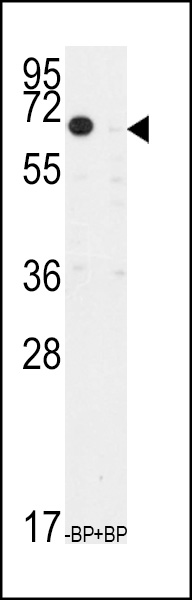 Western blot analysis of anti-TIEG Antibody pre-incubated with and without blocking peptide in CEM cell line lysate. Western blot analysis of anti-TIEG Antibody pre-incubated with and without blocking peptide in CEM cell line lysate.