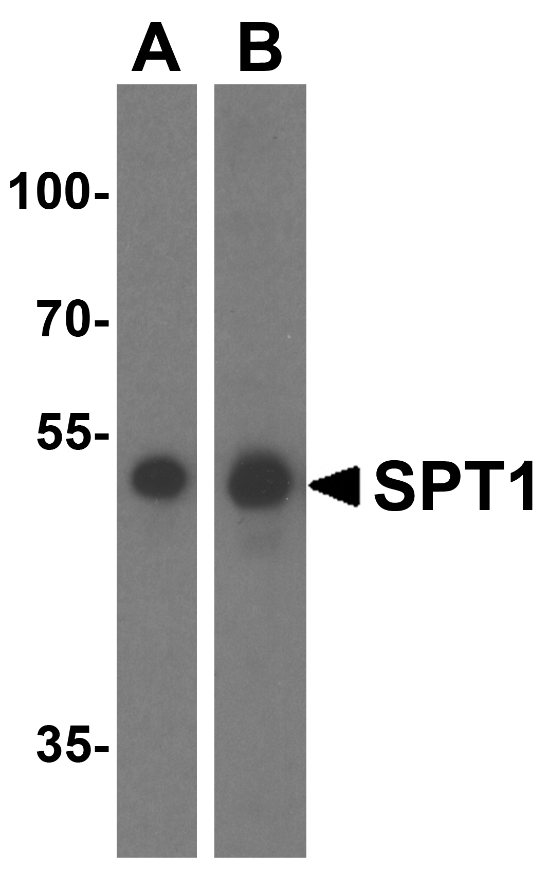 Western blot analysis of SPT1 in (A) A549 and (B) HeLa cell lysate with SPT1 antibody at 1 μg/mL. Western blot analysis of SPT1 in (A) A549 and (B) HeLa cell lysate with SPT1 antibody at 1 μg/mL.
