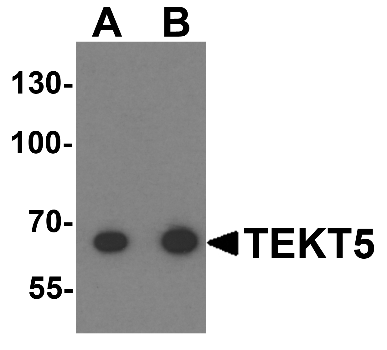 Western blot analysis of TEKT5 in 3T3 cell lysate with TEKT5 antibody at (A) 0.25 and (B) 0.5 μg/mL. Western blot analysis of TEKT5 in 3T3 cell lysate with TEKT5 antibody at (A) 0.25 and (B) 0.5 μg/mL.