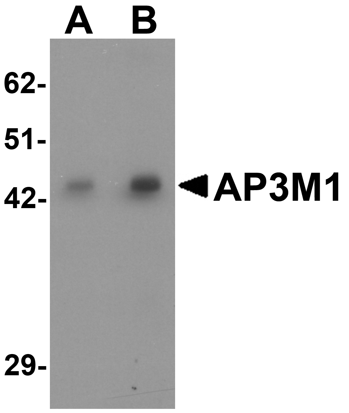 Western blot analysis of AP3M1 in human brain tissue lysate with AP3M1 antibody at (A) 1 and (B) 2 μg/mL . Western blot analysis of AP3M1 in human brain tissue lysate with AP3M1 antibody at (A) 1 and (B) 2 μg/mL .