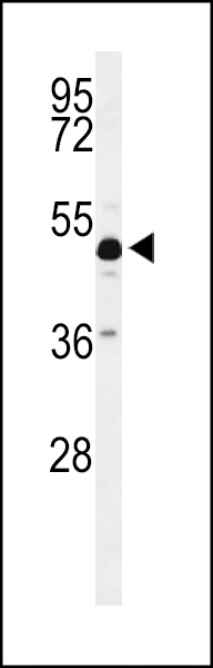 Western blot analysis of ANKH Antibody in mouse cerebellum tissue lysates (35ug/lane) Western blot analysis of ANKH Antibody in mouse cerebellum tissue lysates (35ug/lane)