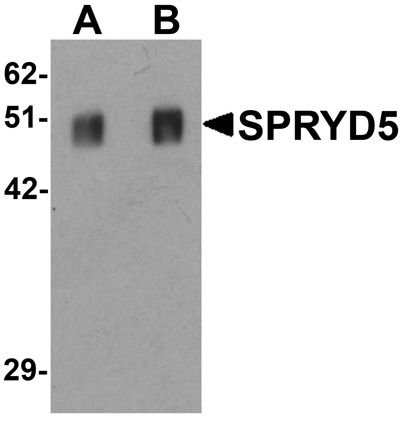 Western blot analysis of SPRYD5 in rat brain tissue lysate with SPRYD5 antibody at (A) 0.25 and (B) 0.5 μg/mL . Western blot analysis of SPRYD5 in rat brain tissue lysate with SPRYD5 antibody at (A) 0.25 and (B) 0.5 μg/mL .