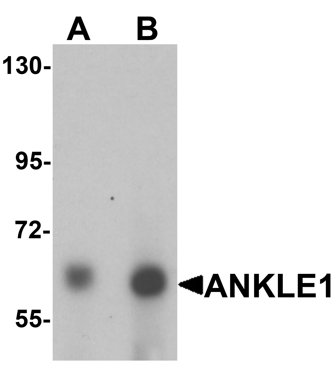 Western blot analysis of ANKLE1 in 293 cell lysate with ANKLE1 antibody at (A) 1 and (B) 2 μg/mL. Western blot analysis of ANKLE1 in 293 cell lysate with ANKLE1 antibody at (A) 1 and (B) 2 μg/mL.