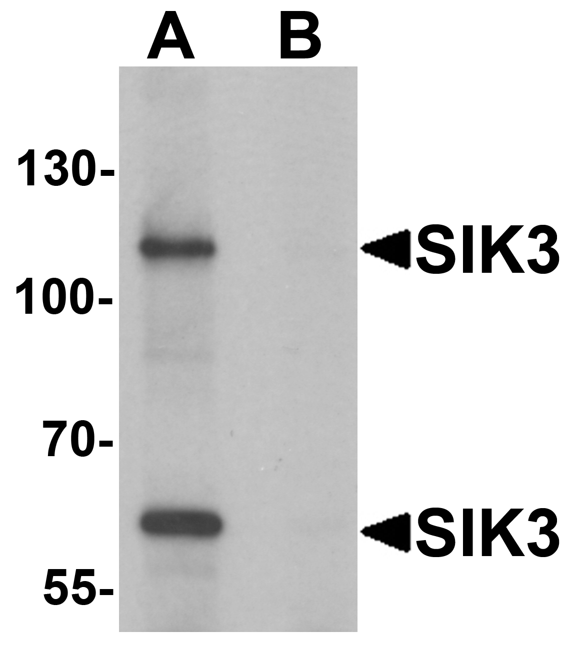 Western blot analysis of SIK3 in rat brain tissue lysate with SIK3 antibody at 1 μg/mL in (A) the absence and (B) the presence of blocking peptide. Western blot analysis of SIK3 in rat brain tissue lysate with SIK3 antibody at 1 μg/mL in (A) the absence and (B) the presence of blocking peptide.