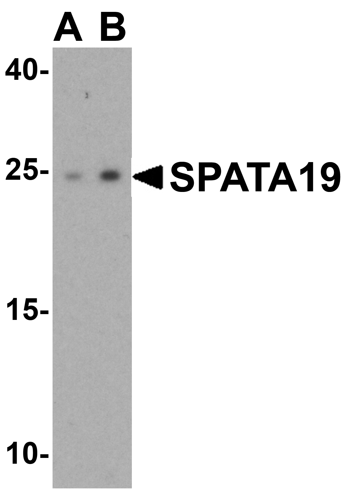Western blot analysis of SPATA19 in human testis tissue lysate with SPATA19 antibody at (A) 1 and (B) 2 μg/mL. Western blot analysis of SPATA19 in human testis tissue lysate with SPATA19 antibody at (A) 1 and (B) 2 μg/mL.