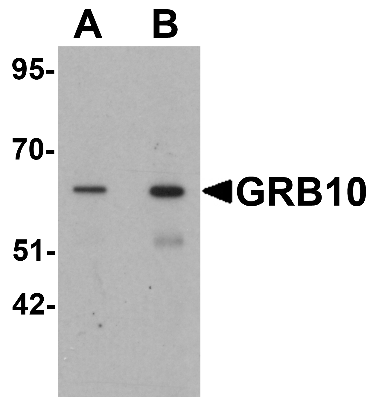 Western blot analysis of GRB10 in SK-N-SH cell lysate with GRB10 antibody at (A) 1 and (B) 2 μg/mL. Western blot analysis of GRB10 in SK-N-SH cell lysate with GRB10 antibody at (A) 1 and (B) 2 μg/mL.