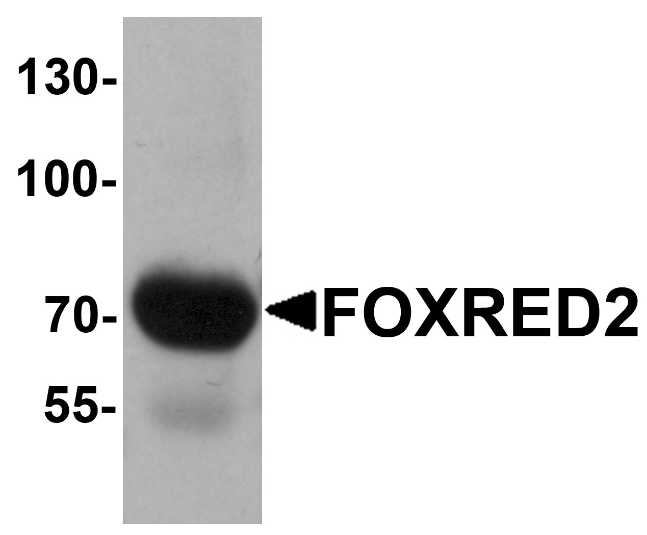 Western blot analysis of FOXRED2 in human lung tissue lysate with FOXRED2 antibody at 1 μg/mL. Western blot analysis of FOXRED2 in human lung tissue lysate with FOXRED2 antibody at 1 μg/mL.
