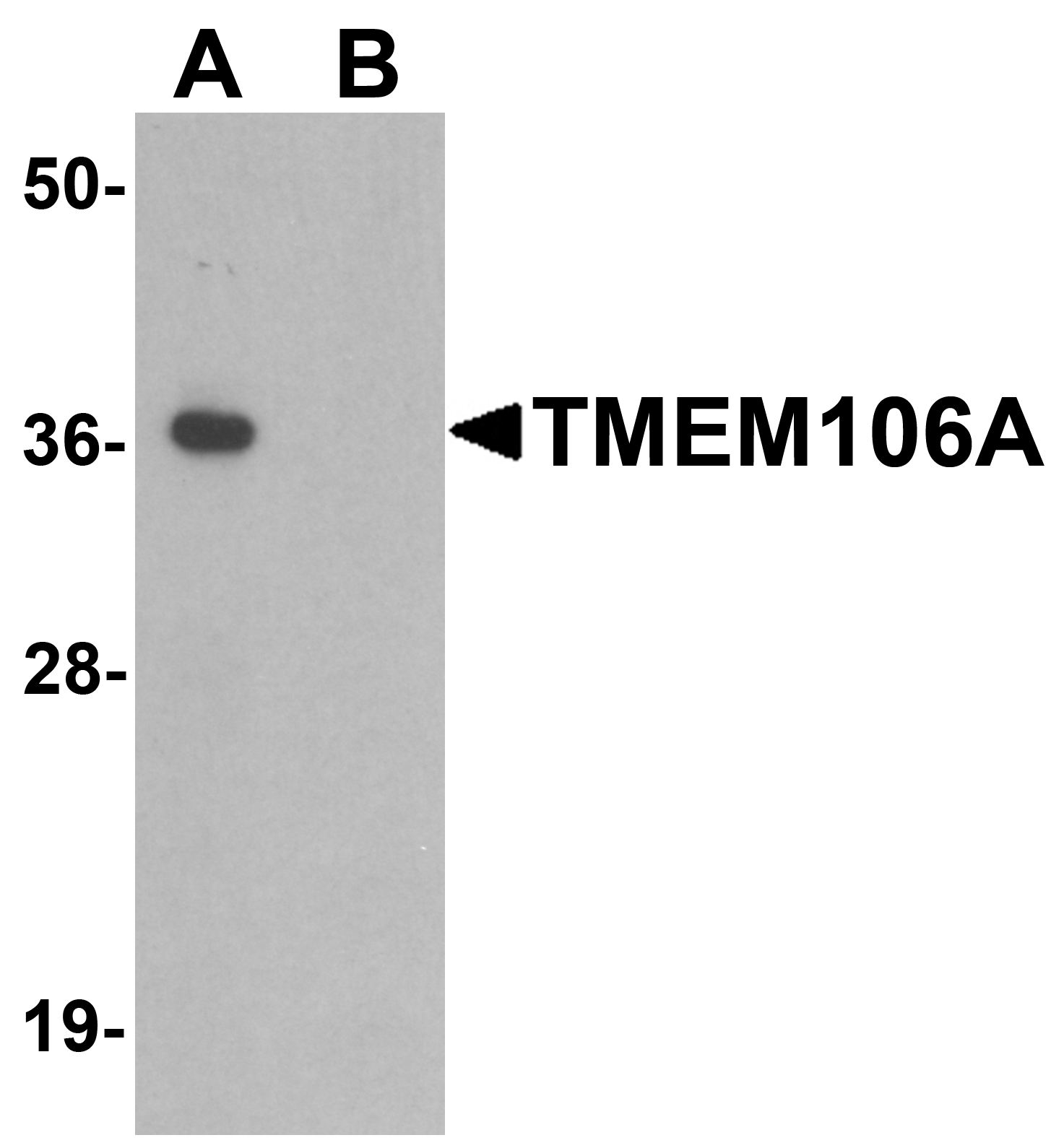 Western blot analysis of TMEM106A in A-20 cell lysate with TMEM106A antibody at 1 μg/mL in (A) the absence and (B) the presence of blocking peptide. Western blot analysis of TMEM106A in A-20 cell lysate with TMEM106A antibody at 1 μg/mL in (A) the absence and (B) the presence of blocking peptide.