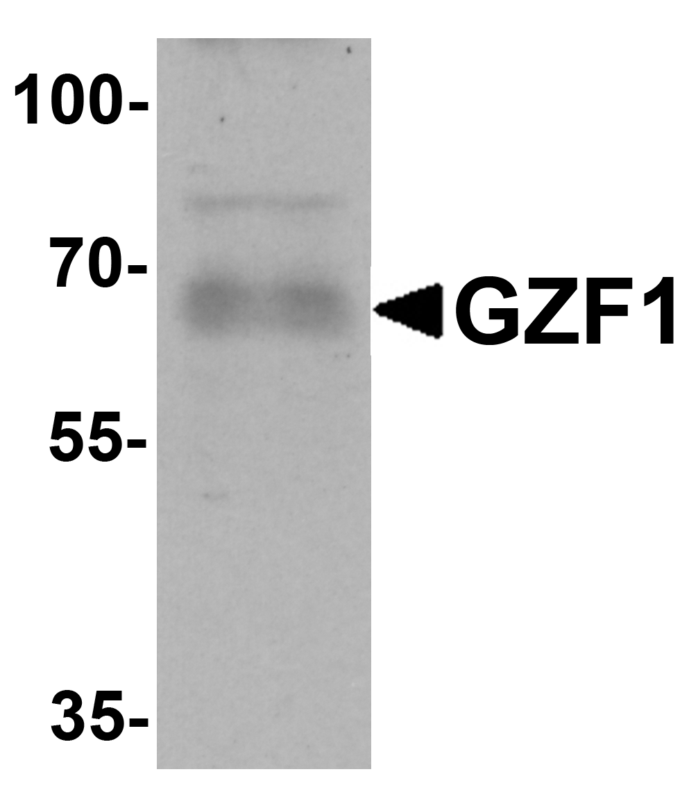 Western blot analysis of GZF1 in human heart tissue lysate with GZF1 antibody at 1 μg/mL. Western blot analysis of GZF1 in human heart tissue lysate with GZF1 antibody at 1 μg/mL.