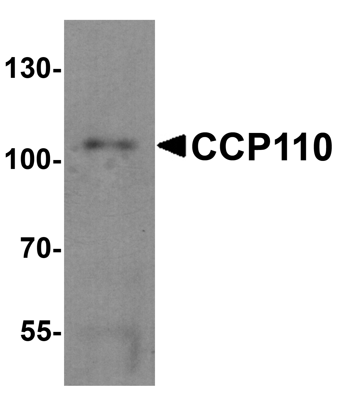 Western blot analysis of CCP110 in human colon tissue lysate with CCP110 antibody at 1 μg/mL.