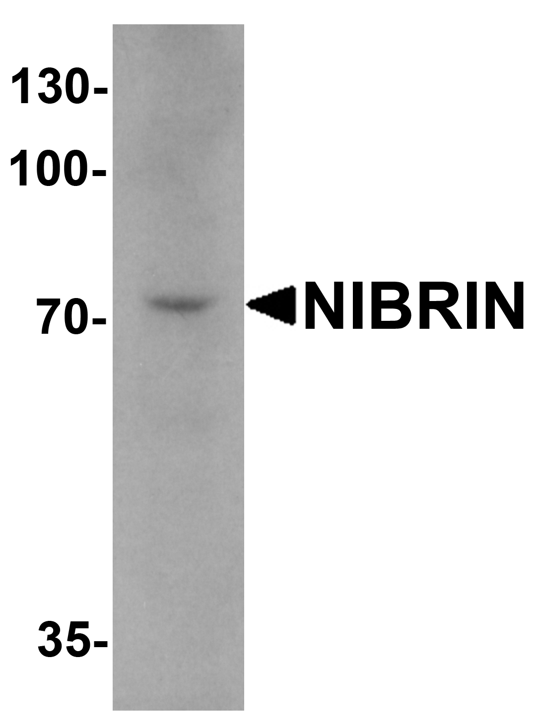 Western blot analysis of NIBRIN in mouse lung tissue lysate with NIBRIN antibody at 1 μg/mL. Western blot analysis of NIBRIN in mouse lung tissue lysate with NIBRIN antibody at 1 μg/mL.