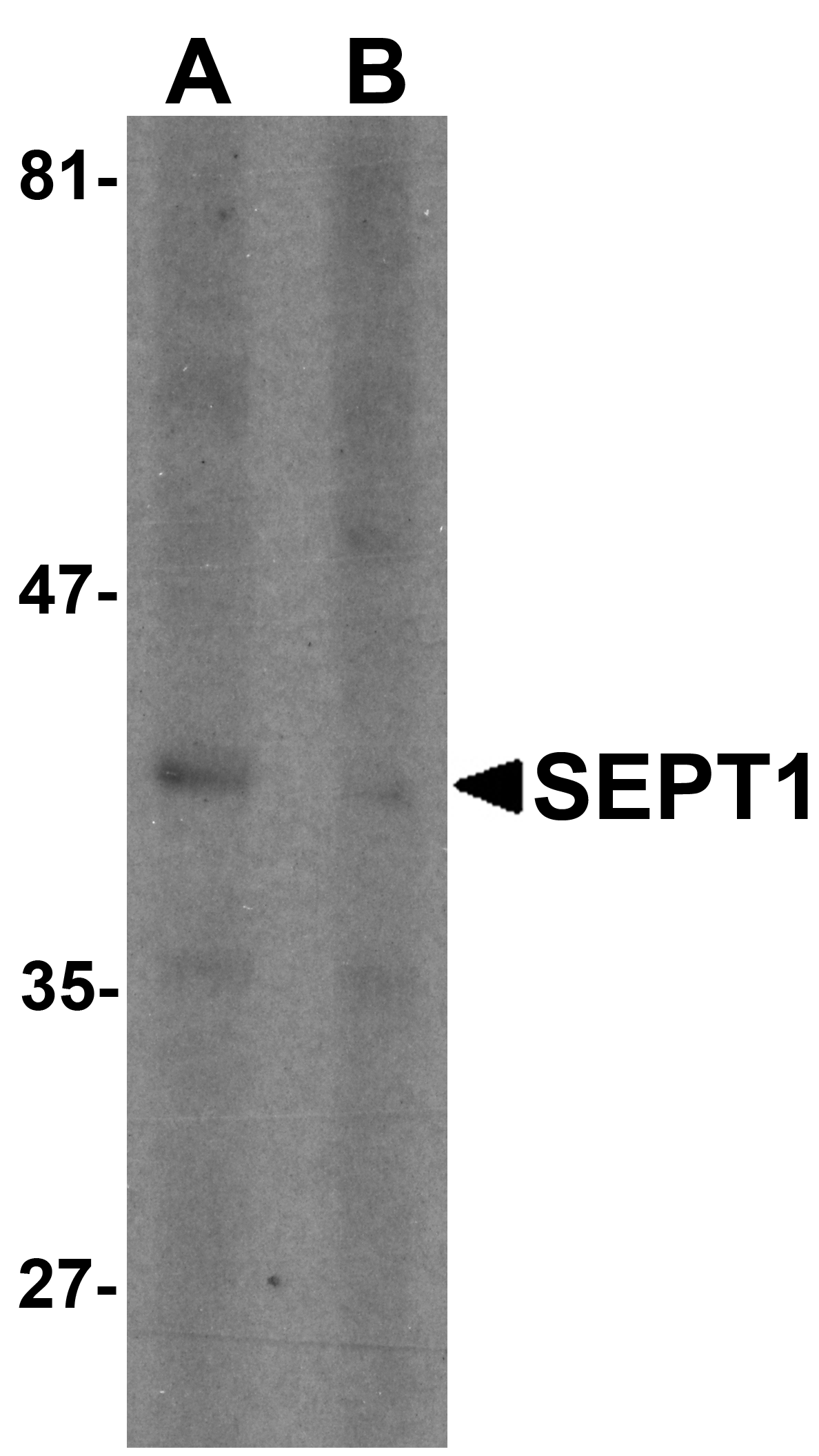 Western blot analysis of SEPT1 in Raji cell lysate with SEPT1 antibody at 1 μg/ml in (A) the absence and (B) the presence of blocking peptide. Western blot analysis of SEPT1 in Raji cell lysate with SEPT1 antibody at 1 μg/ml in (A) the absence and (B) the presence of blocking peptide.