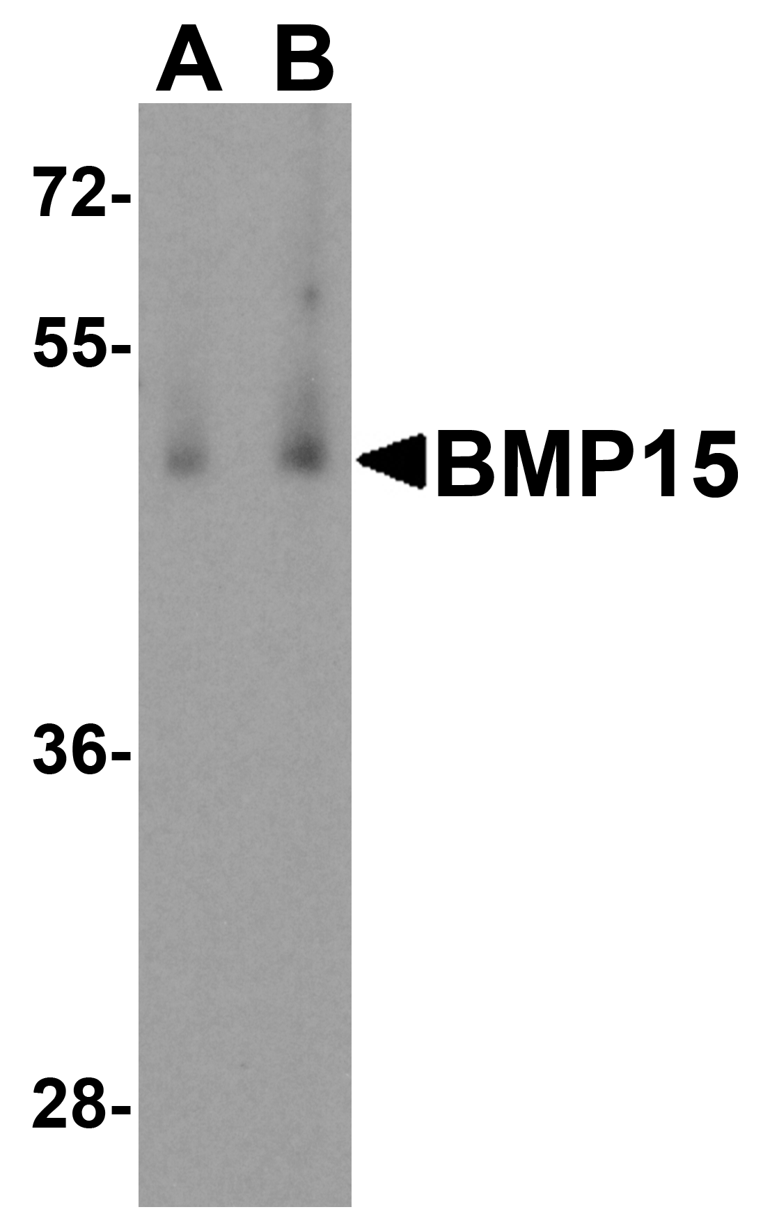 Western blot analysis of BMP15 in human testis tissue lysate with BMP15 antibody at (A) 1 and (B) 2 μg/mL. Western blot analysis of BMP15 in human testis tissue lysate with BMP15 antibody at (A) 1 and (B) 2 μg/mL.