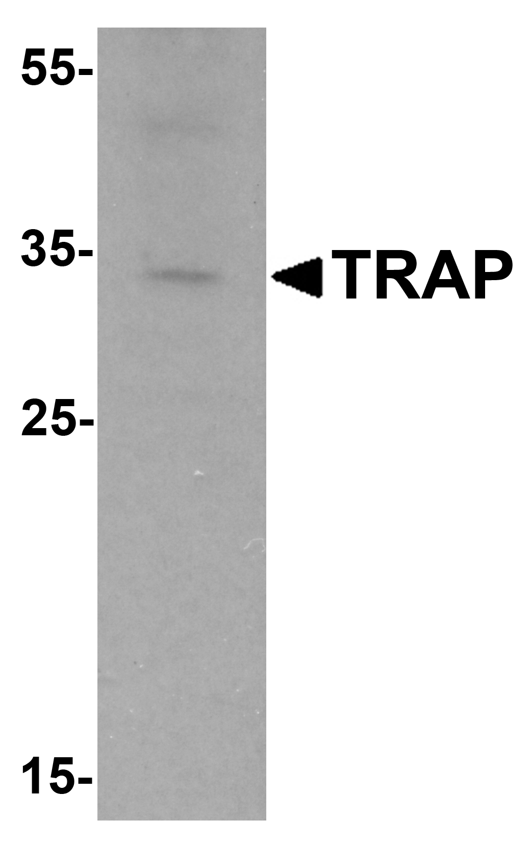 Western blot analysis of TRAP in mouse brain tissue lysate with TRAP antibody at 1 μg/mL. Western blot analysis of TRAP in mouse brain tissue lysate with TRAP antibody at 1 μg/mL.