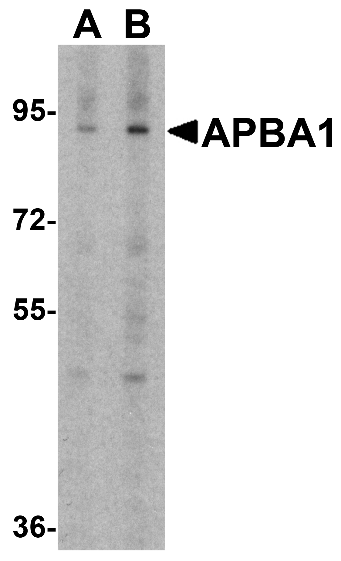Western blot analysis of APBA1 in rat brain tissue lysate with APBA1 antibody at 0.5 μg/ml in (A) the absence and (B) the presence of blocking peptide. Western blot analysis of APBA1 in rat brain tissue lysate with APBA1 antibody at 0.5 μg/ml in (A) the absence and (B) the presence of blocking peptide.