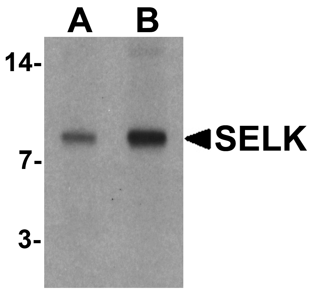 Western blot analysis of SELK in A20 cell lysate with SELK antibody at (A) 1 and (B) 2 μg/mL. Western blot analysis of SELK in A20 cell lysate with SELK antibody at (A) 1 and (B) 2 μg/mL.