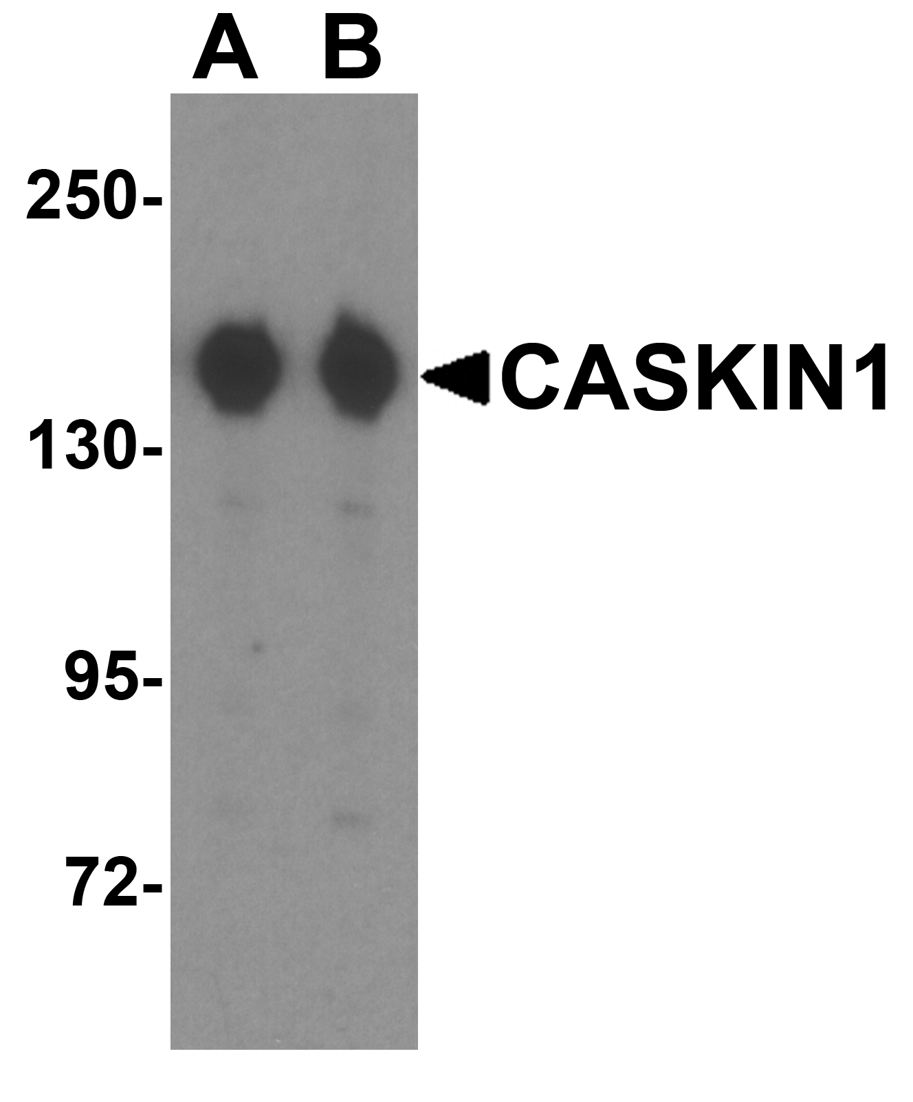 Western blot analysis of CASKIN1 in HeLa cell lysate with CLAUDIN4 antibody at (A) 0.25 and (B) 0.5 μg/mL. Western blot analysis of CASKIN1 in HeLa cell lysate with CLAUDIN4 antibody at (A) 0.25 and (B) 0.5 μg/mL.