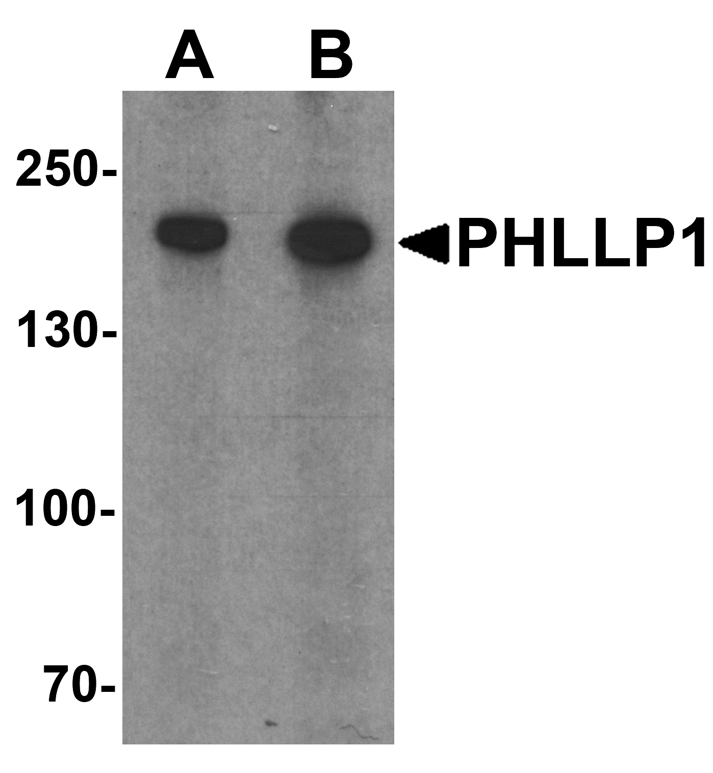Western blot analysis of PHLPP1 in SW480 cell lysate with PHLPP1 antibody at (A) 1 and (B) 2 μg/mL. Western blot analysis of PHLPP1 in SW480 cell lysate with PHLPP1 antibody at (A) 1 and (B) 2 μg/mL.