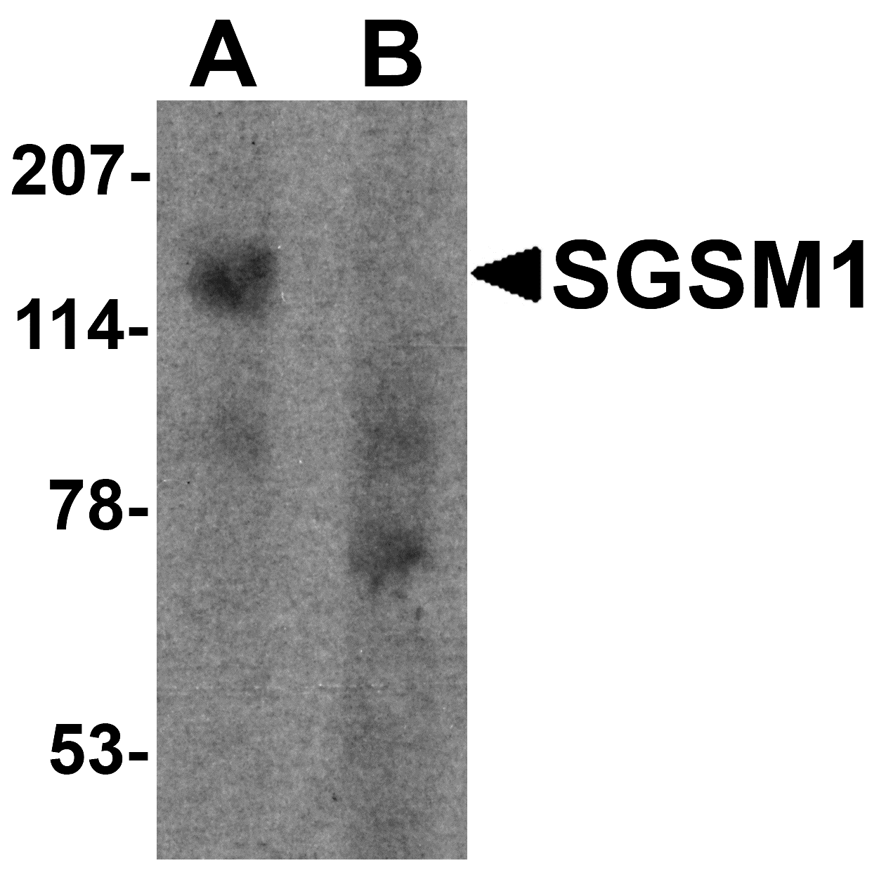 Western blot analysis of SGSM1 in human cerebellum tissue lysate with SGSM1 antibody at 1 μg/ml in (A) the absence and (B) the presence of blocking peptide. Western blot analysis of SGSM1 in human cerebellum tissue lysate with SGSM1 antibody at 1 μg/ml in (A) the absence and (B) the presence of blocking peptide.
