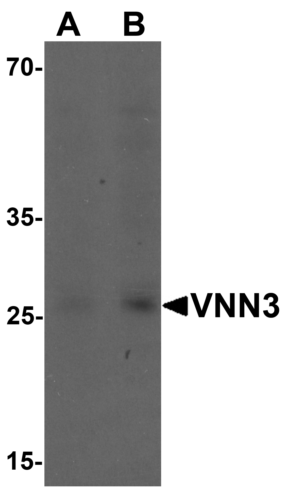 Western blot analysis of VNN3 in human brain tissue lysate with VNN3 antibody at (A) 0.5 and (B) 1 μg/mL. Western blot analysis of VNN3 in human brain tissue lysate with VNN3 antibody at (A) 0.5 and (B) 1 μg/mL.