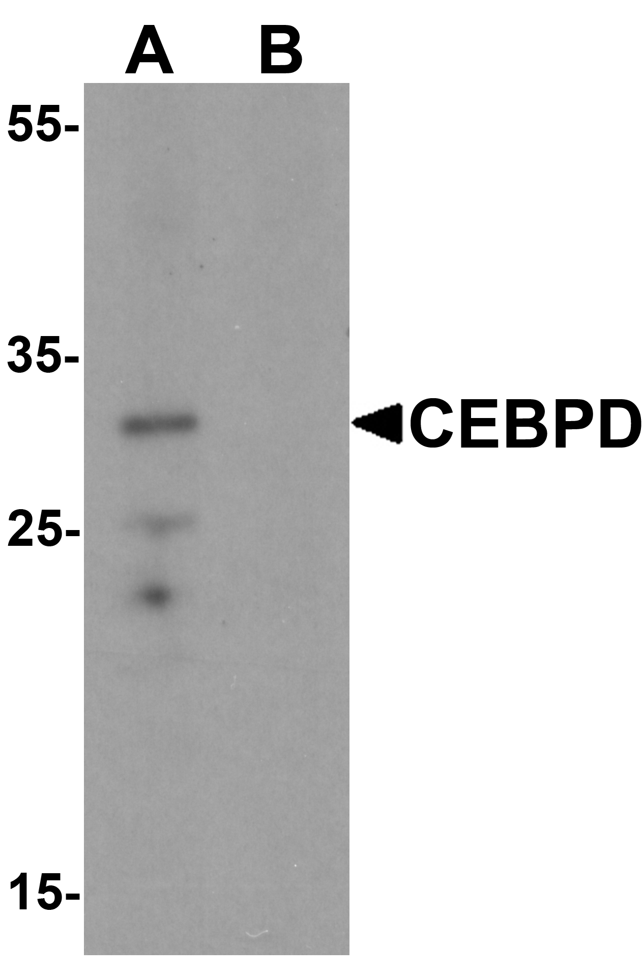 Western blot analysis of CEBPD in rat spleen tissue lysate with CEBPD antibody at 0.5 μg/mL in (A) the absence and (B) the presence of blocking peptide. Western blot analysis of CEBPD in rat spleen tissue lysate with CEBPD antibody at 0.5 μg/mL in (A) the absence and (B) the presence of blocking peptide.