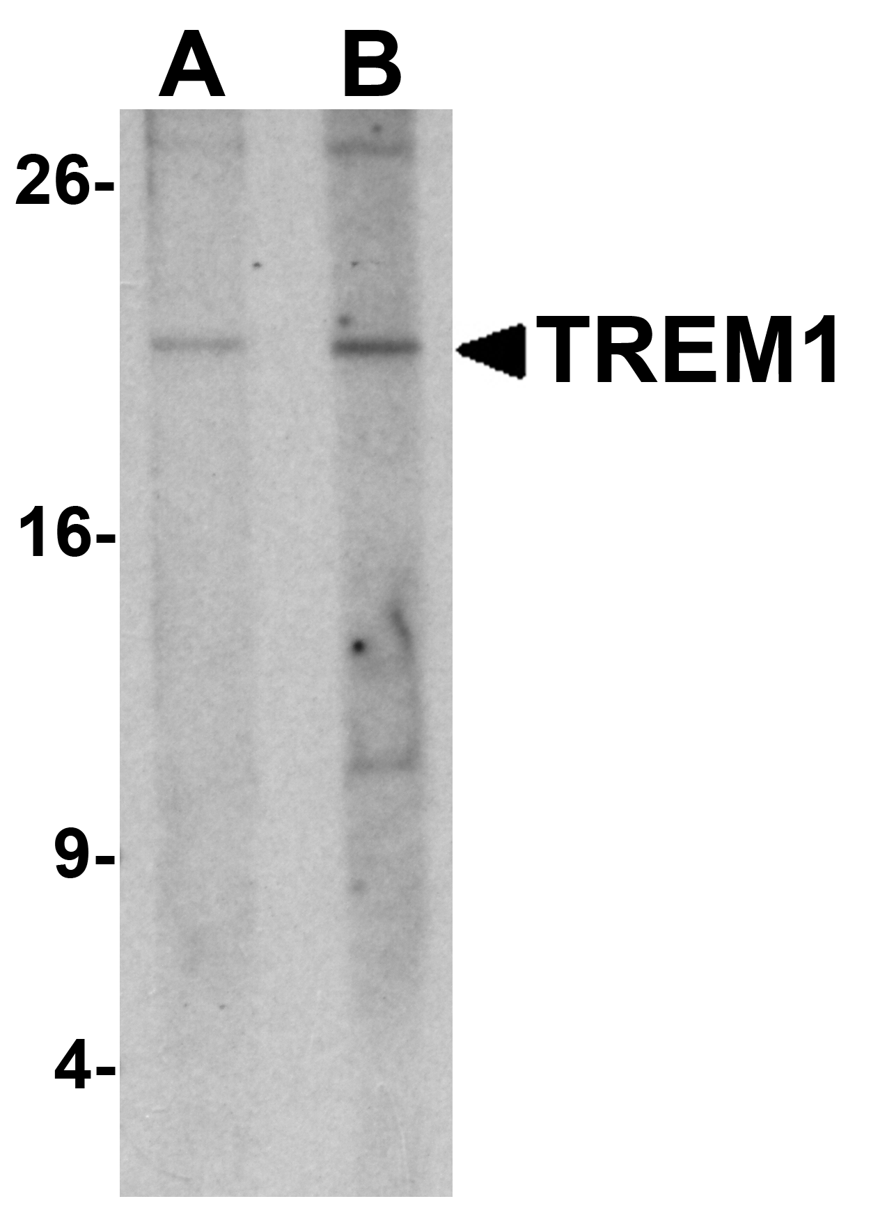 Western blot analysis of TREM1 in 293 cell lysate with TREM1 antibody at (A) 1 and (B) 2 μg/mL. Western blot analysis of TREM1 in 293 cell lysate with TREM1 antibody at (A) 1 and (B) 2 μg/mL.