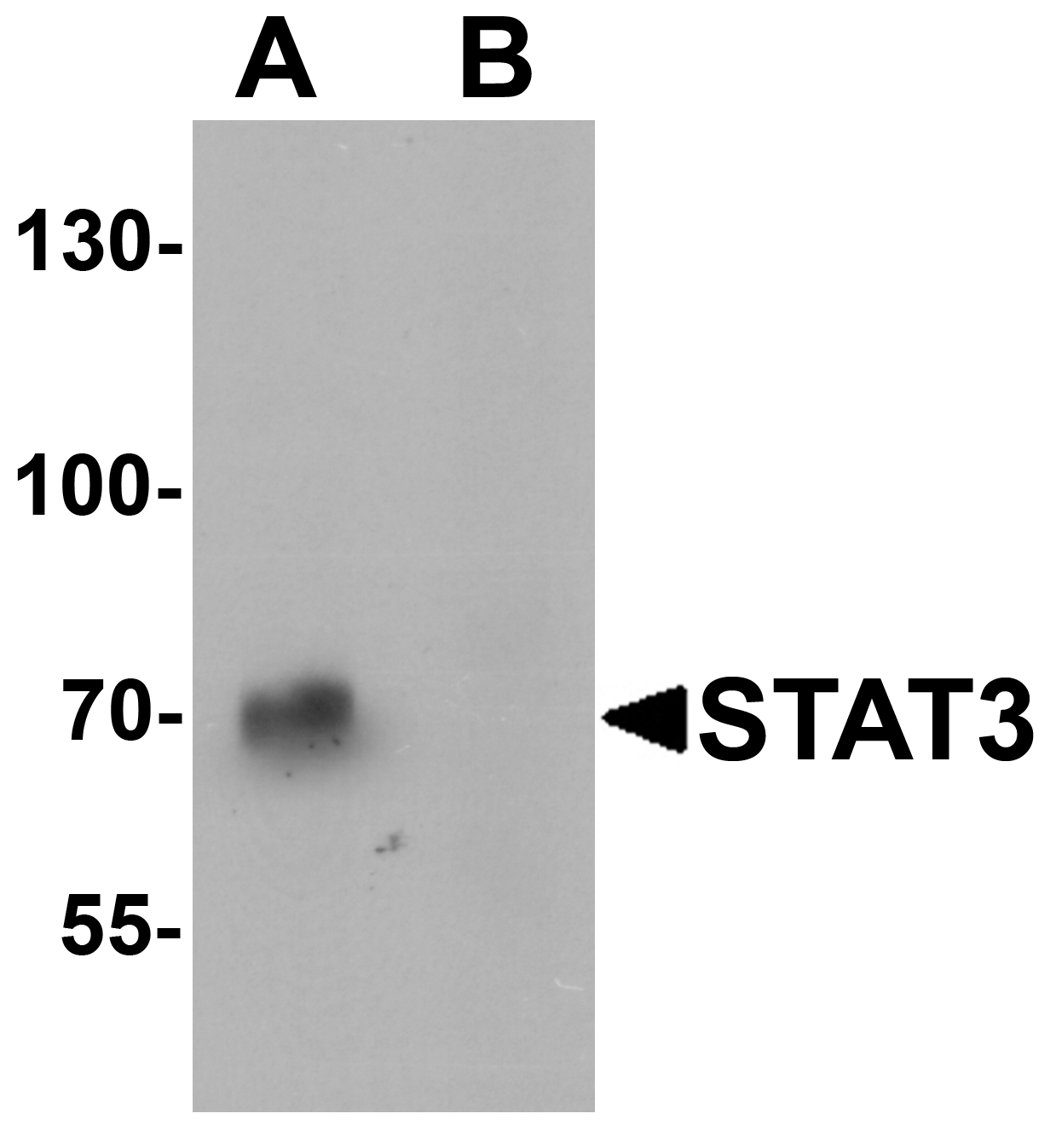 Western blot analysis of STAT3 in human small intestine tissue lysate with STAT3 antibody at 1 μg/mL in (A) the absence and (B) the presence of blocking peptide.