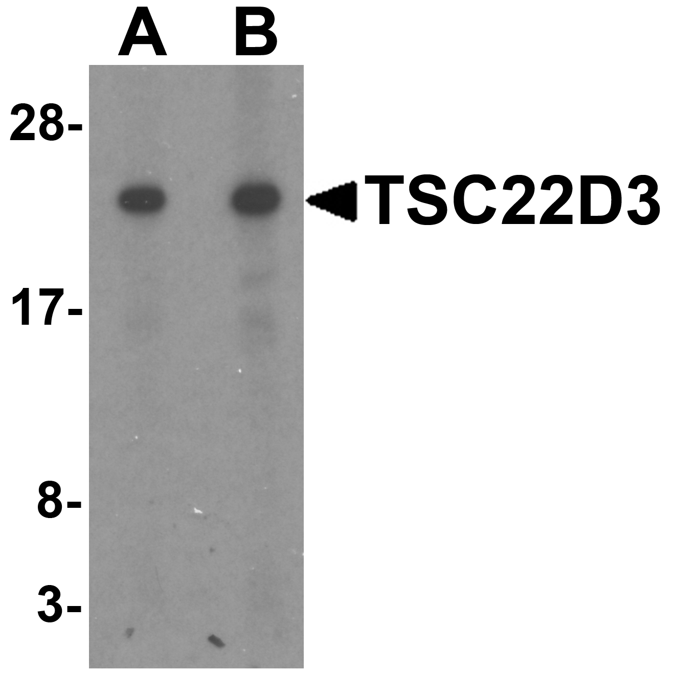 Western blot analysis of TSC22D3 in human small intestine tissue lysate with TSC22D3 antibody at (A) 1 and (B) 2 μg/mL. Western blot analysis of TSC22D3 in human small intestine tissue lysate with TSC22D3 antibody at (A) 1 and (B) 2 μg/mL.
