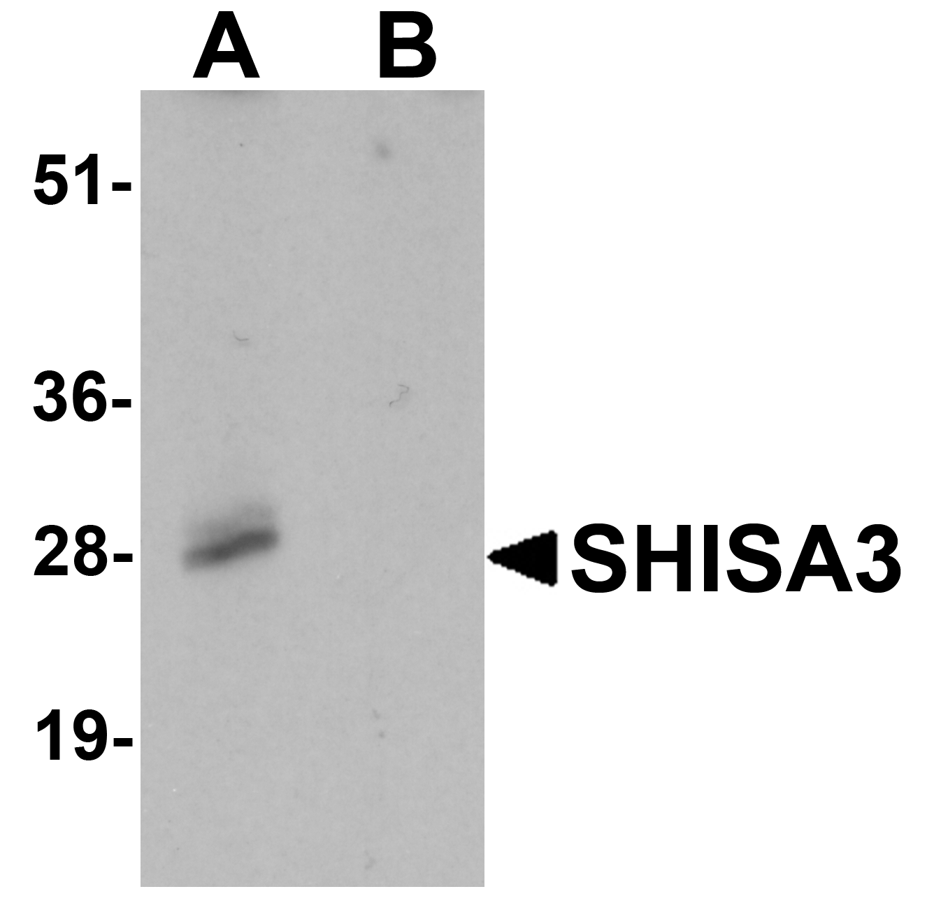 Western blot analysis of SHISA3 in human small intestine Tissue lysate with SHISA3 antibody at 1 μg/mL in (A) the absence and (B) the presence of blocking peptide. Western blot analysis of SHISA3 in human small intestine Tissue lysate with SHISA3 antibody at 1 μg/mL in (A) the absence and (B) the presence of blocking peptide.