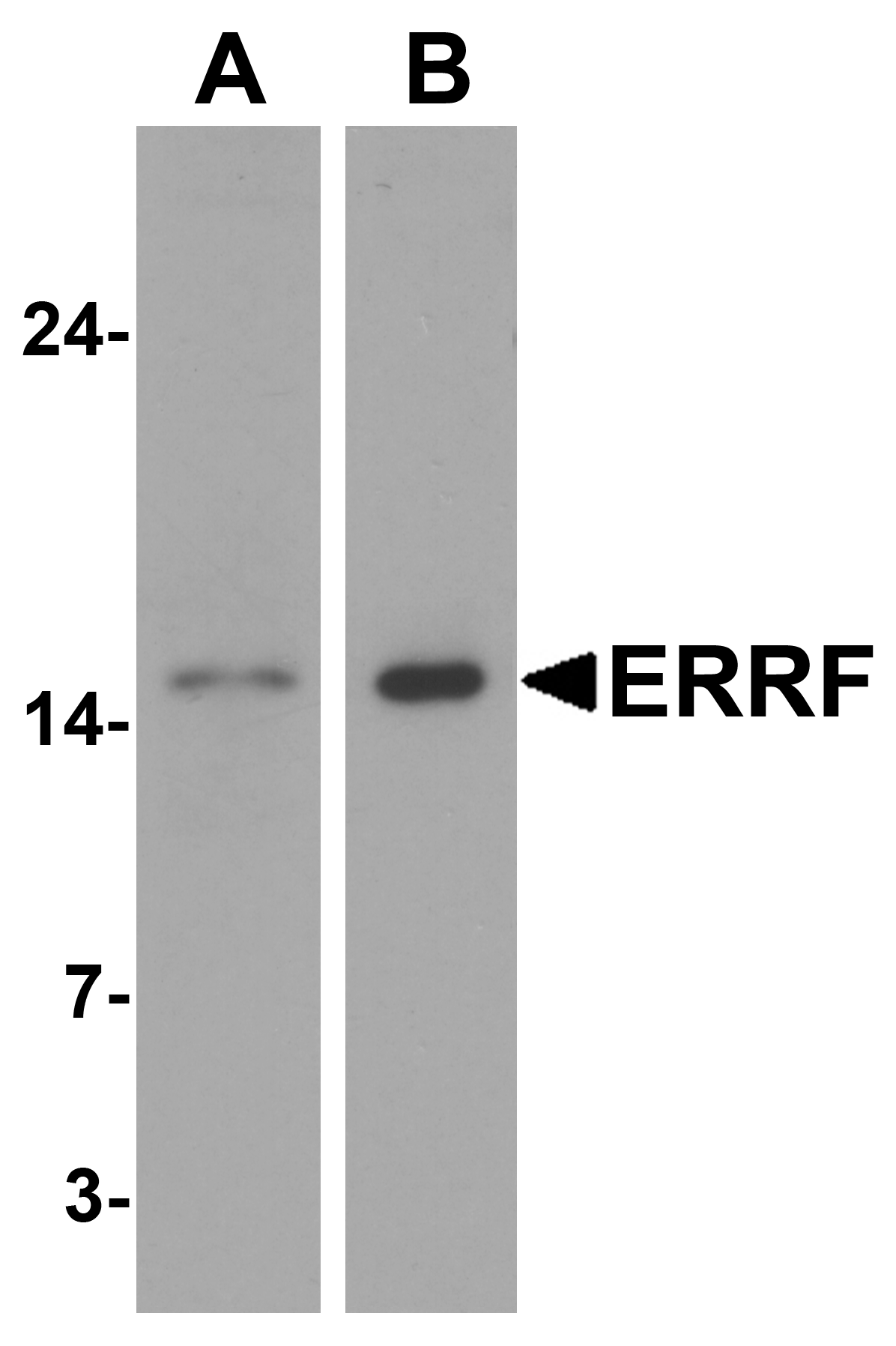Western blot analysis of ERRF in (A) HeLa and (B) A-20 cell lysate with ERRF antibody at 1 μg/mL. Western blot analysis of ERRF in (A) HeLa and (B) A-20 cell lysate with ERRF antibody at 1 μg/mL.