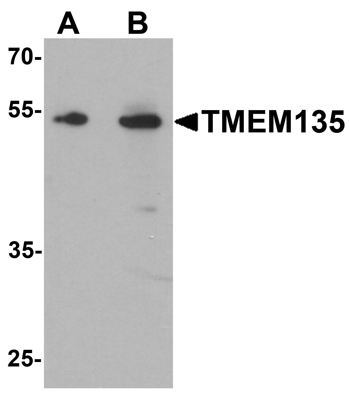 Western blot analysis of TMEM135 in rat liver tissue lysate with TMEM135 antibody at (A) 1 and (B) 2 μg/mL.