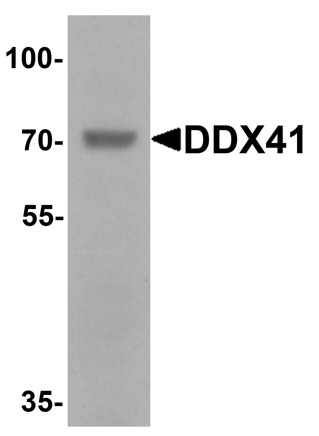 Western blot analysis of DDX41 in rat brain tissue lysate with DDX41 antibody at 1 μg/mL.