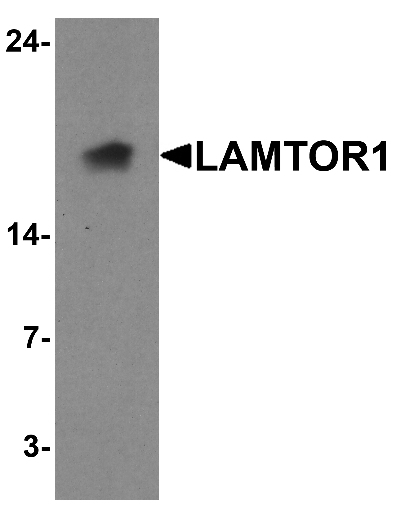 Western blot analysis of LAMTOR1 in A431 cell lysate with LAMTOR1 antibody at 1 μg/ml. Western blot analysis of LAMTOR1 in A431 cell lysate with LAMTOR1 antibody at 1 μg/ml.