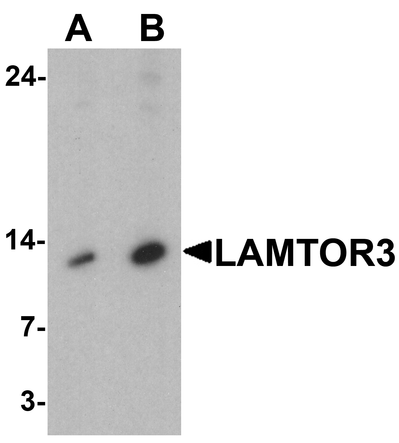 Western blot analysis of LAMTOR3 in human brain tissue lysate with LAMTOR3 antibody at (A) 1 and (B) 2 μg/ml Western blot analysis of LAMTOR3 in human brain tissue lysate with LAMTOR3 antibody at (A) 1 and (B) 2 μg/ml